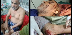 সাংবাদিক আকবর আলী কে হত্যার উদ্দেশ্য কুপিয়ে মারাত্মক জখম করেছে 