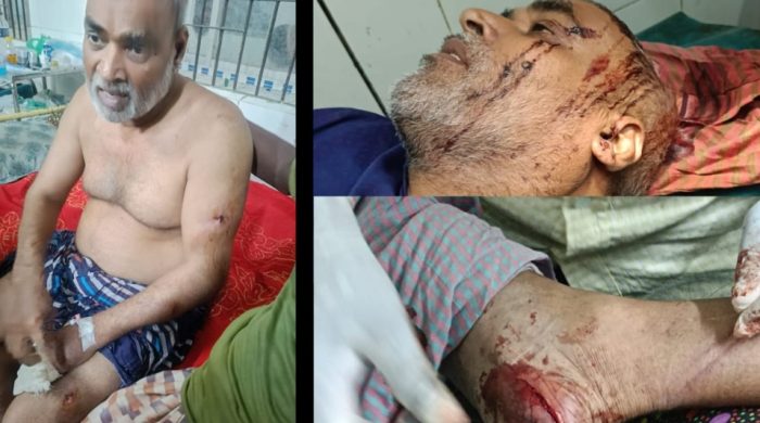সাংবাদিক আকবর আলী কে হত্যার উদ্দেশ্য কুপিয়ে মারাত্মক জখম করেছে